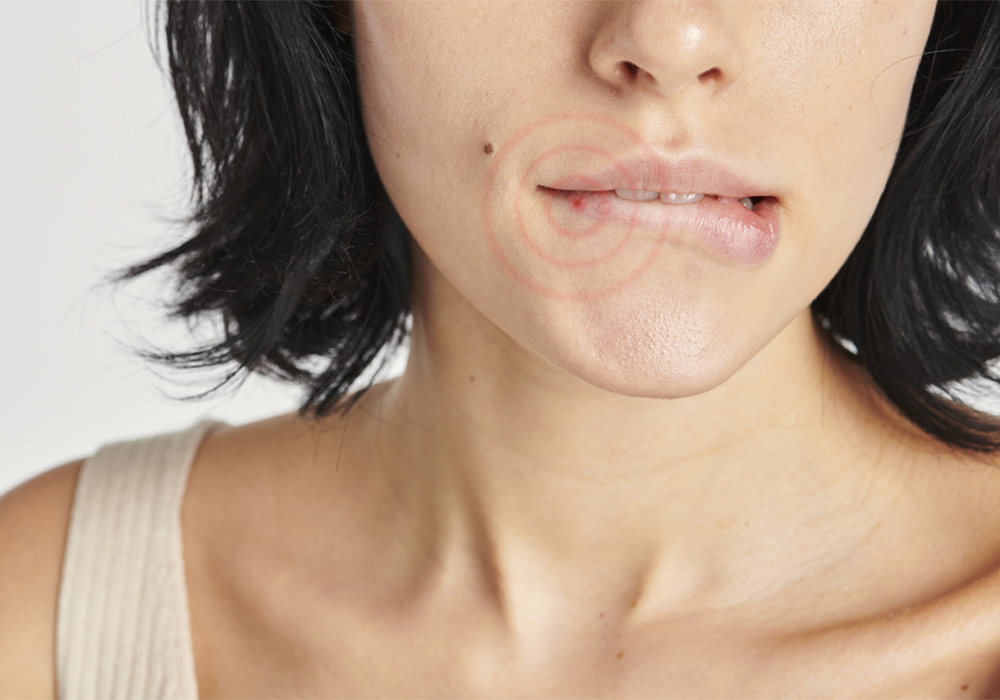 О герпесе в вопросах и ответах О герпесе в вопросах и ответах